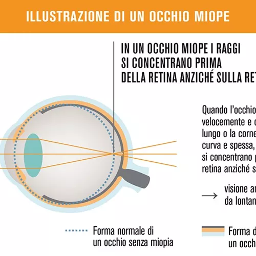 Grafica arancione HOYA MiYOSMART con testo in italiano