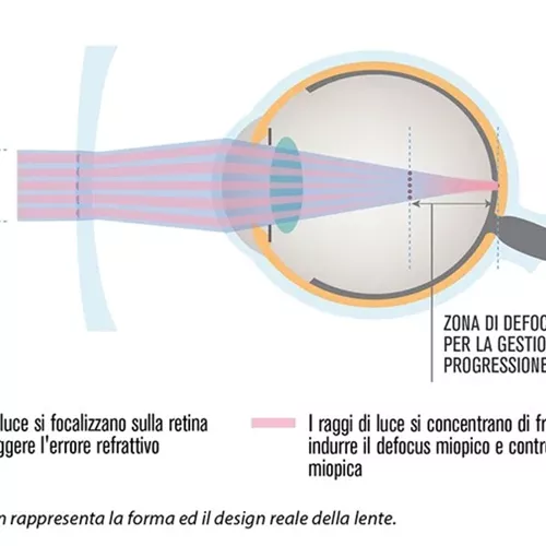 HOYA MiYOSMART grafica italiana
