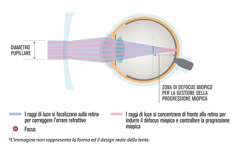 https://www.hoyavision.com/globalassets/holi/hoya_miyosmart_tecnologia-dims_def.jpg?width=800&upScale=false&mode=crop