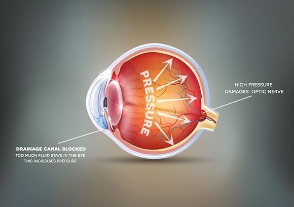Eye diseases animation