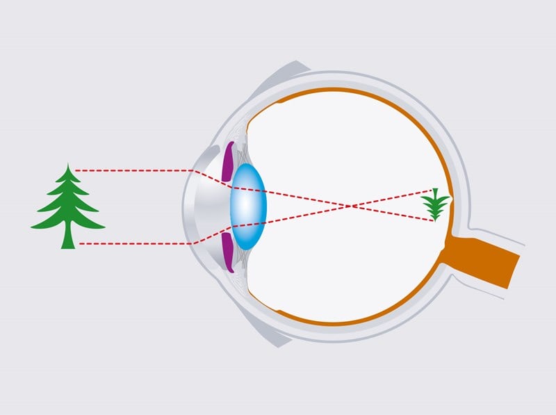 Animation showing how you see using a tree to demonstrate