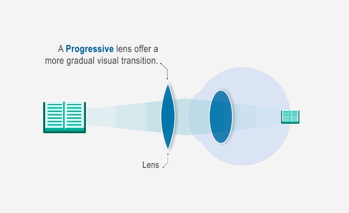 How to correct presbyopia