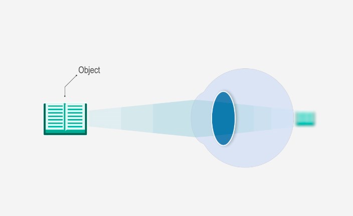 Diagram showing what causes presbyopia